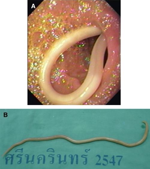 pinworm típusú