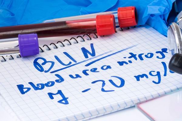 Information on Examination of Kidney Functions You Need to Know