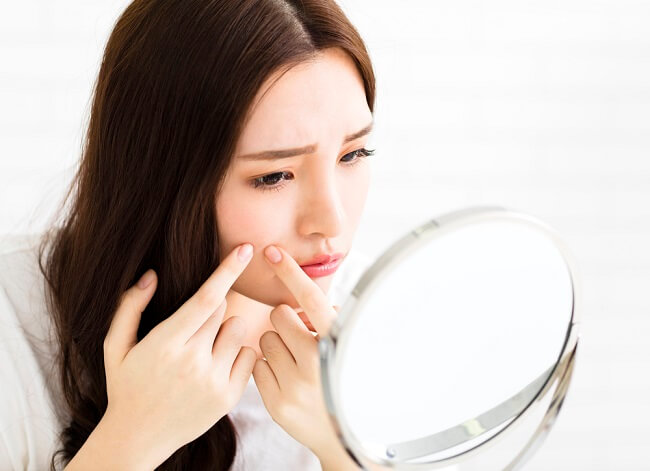 Here's How To Get Pregnant Mom Not Disturbed Acne
