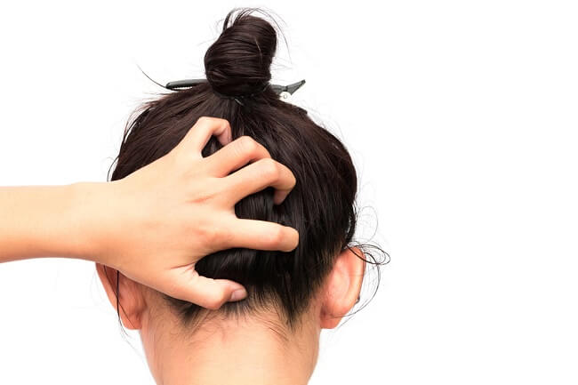 Experiencing Stubborn Dandruff? This is what you need to know