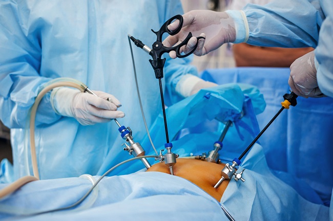 Know What Matters Relate to Laparoscopy
