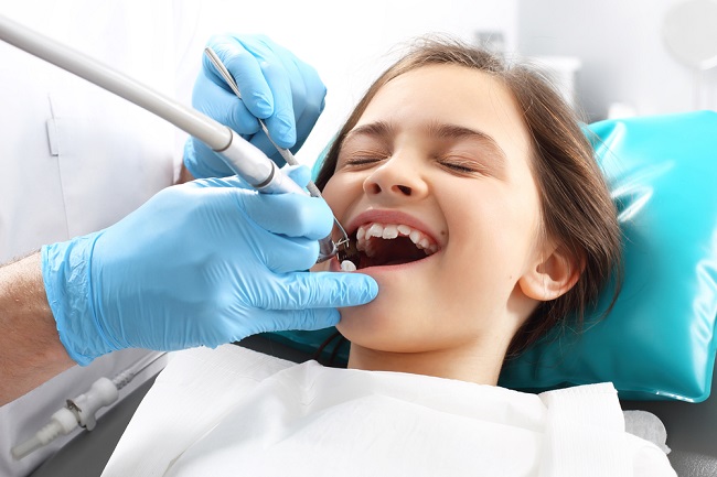 Know What's Scaling Teeth