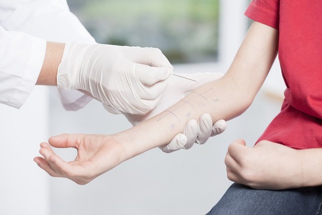 Regarding Protein Allergy You Need To Know