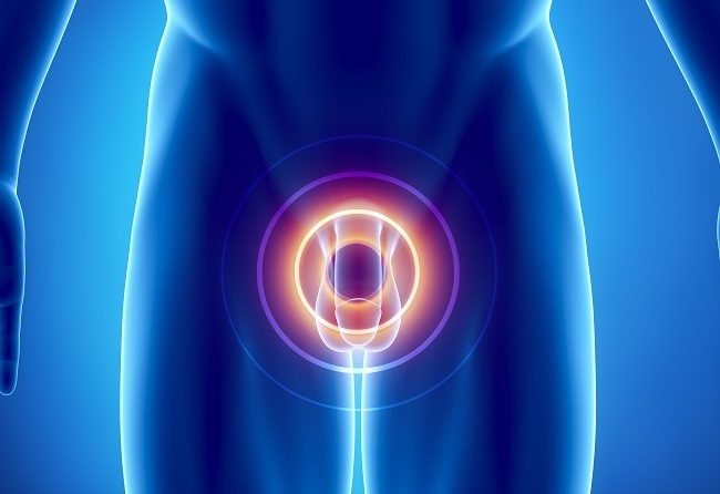 PSA total (antigen specific prostatic)