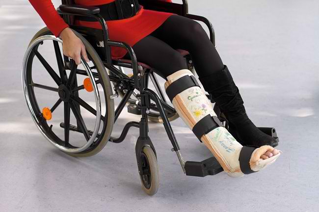 Jangan Dibiarkan Saja, Gips pada Tubuh Harus Dirawat