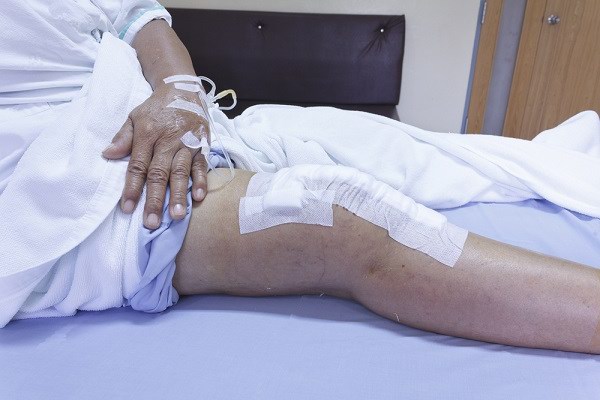 Knee Switch Replacement Things You Need to Know