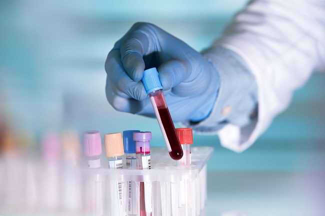 Mengenal Asidosis Dan Pengobatannya Alodokter