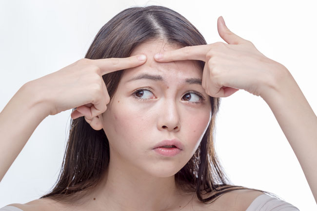 Komedo putih alodokter