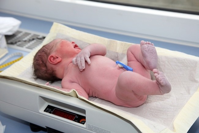 Tes Apgar Score Untuk Cek Kondisi Bayi Baru Lahir Alodokter