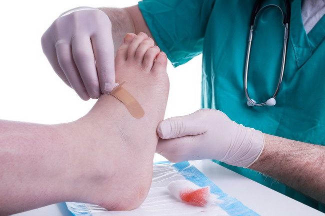 Nothing is called Dry Diabetes or Wet Diabetes - Alodokter