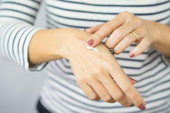 chloroquine sans ordonnance belgique