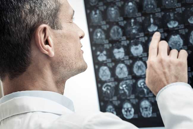 Cari Tahu Peran Dokter Spesialis Neurologi di Sini