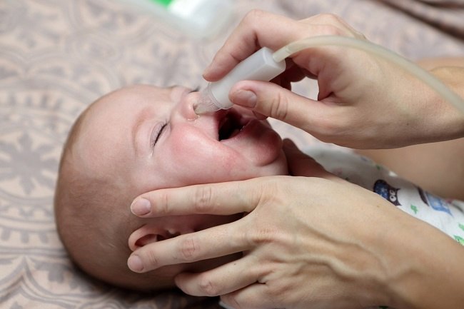 Cara Atasi Hidung Tersumbat Pada Balita