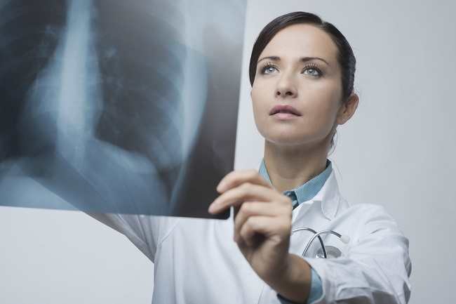 Memahami Peran Dokter Paru di Sini