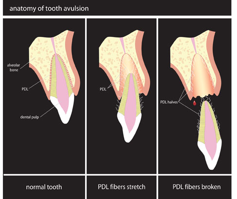 Avulsi Gigi Anatomi. Sumber:Endsurg, Phoenix-Lazerus. Wikimedia Commons, 2004.