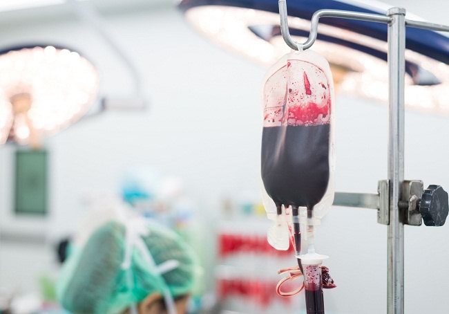 Selain Bermanfaat Transfusi Darah Juga Berisiko Alodokter