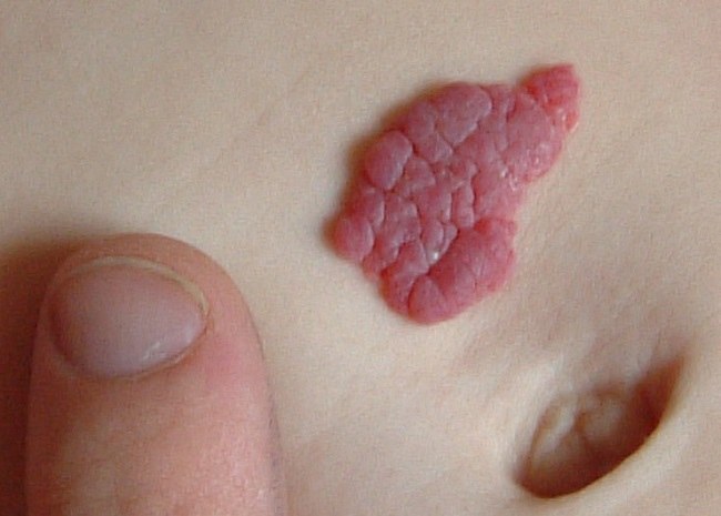 Sumber: Zeimusu, Wikimedia commons, 2006.