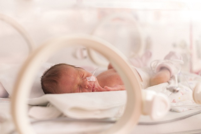 Gangguan Tumbuh Kembang Bayi Prematur yang Sering Terjadi
