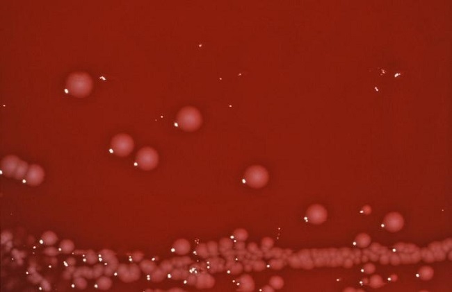 Gambar 1. Shigella Boydii (Sumber : CDC, Wikimedia Commons, 1976)