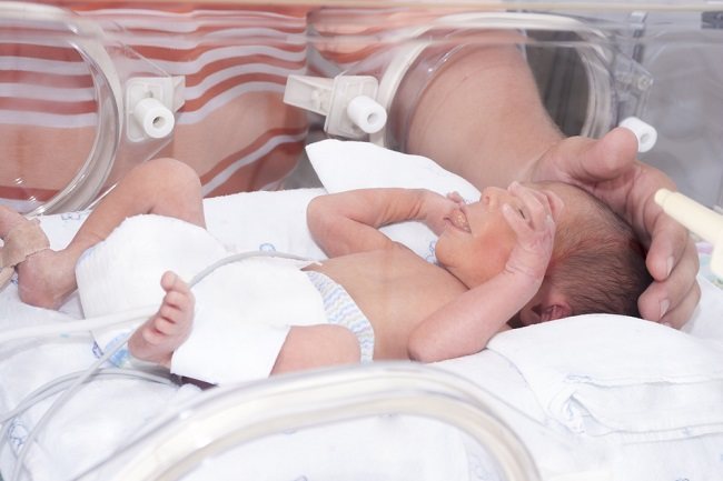 Cara Menghitung Umur Bayi Prematur dan Memantau Perkembangannya