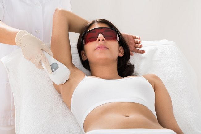 Serba-serbi Menghilangkan Bulu dengan Laser