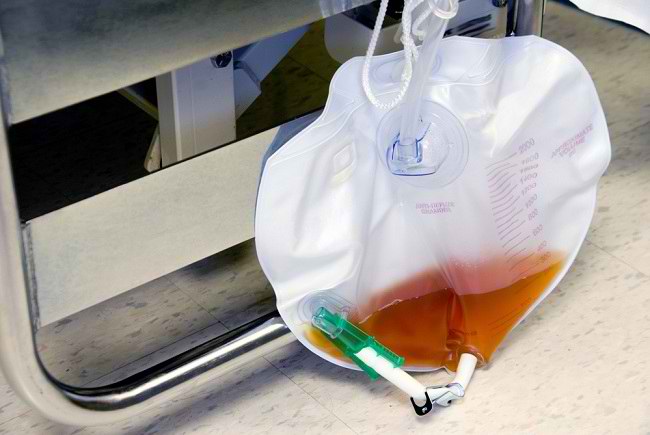 Identifying the Type of Catheter and the Procedure for Use