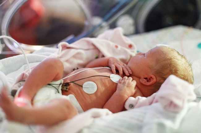 Hydrops Fetalis, Kondisi yang Dapat Mengancam Nyawa Bayi
