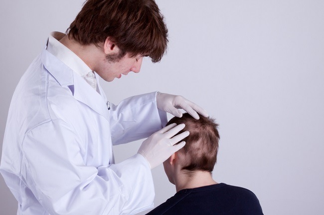 Diagnosis Alopecia Aerata - Alomedika