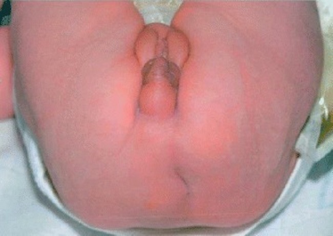 Sumber: Openi, 2010