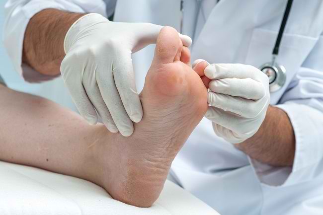 Kenali Penyebab dengan Cara Mengatasi Infeksi Jamur Kulit - Alodokter