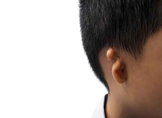 Recognizing Microtia, Deformities of the Earlobe