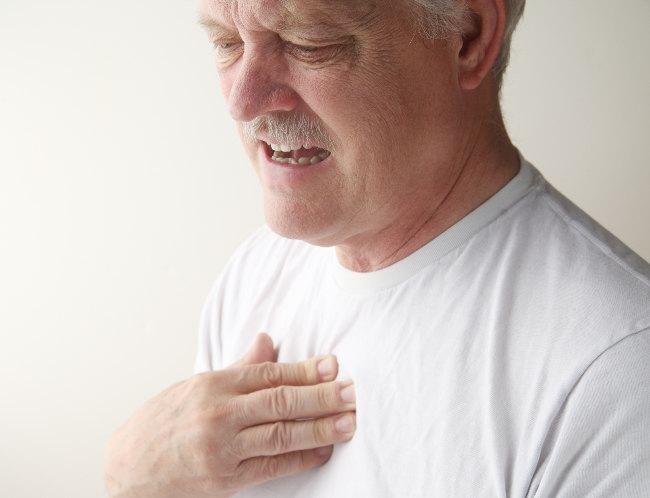Ketoconazole prescription strength