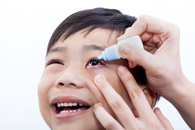 These Causes and Ways to Overcome Eye Infection in Children