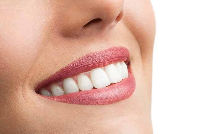 5 Hal yang Harus Diperhatikan Sebelum Bleaching Gigi - Alodokter