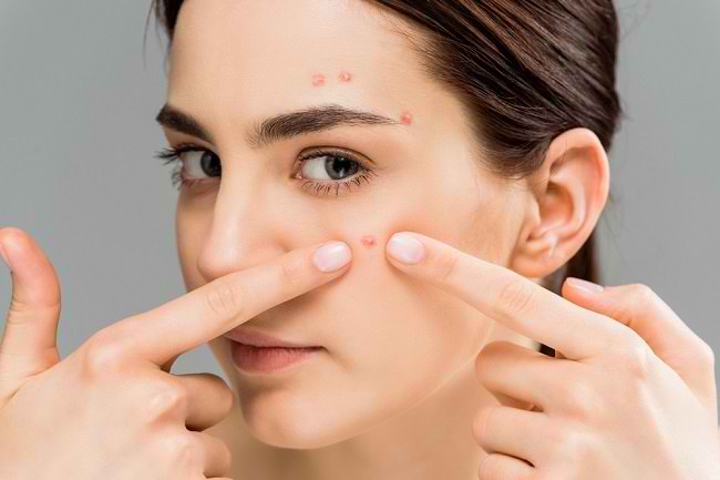 Learn Various Ways to Get Rid of Acne Quickly