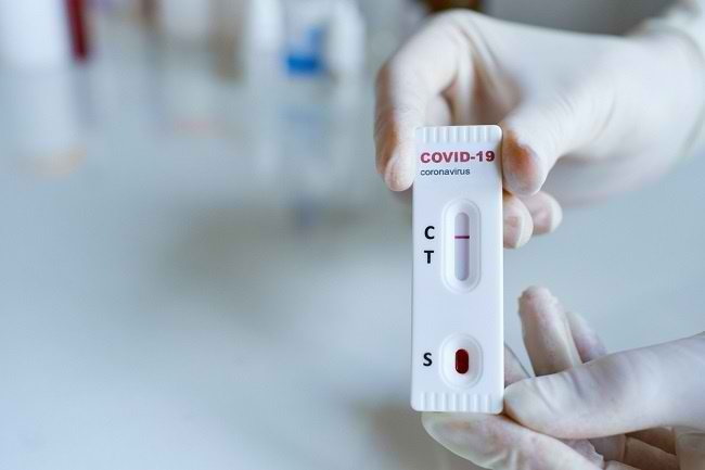 Hasil Rapid Test Covid-19 Negatif, Apa Artinya? - Alodokter