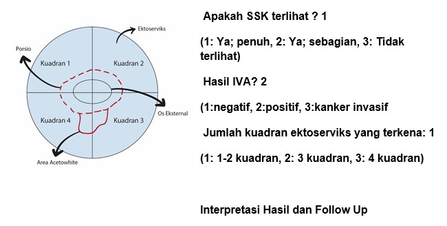 Teknik Pemeriksaan Inspeksi Visual Asetat IVA  Alomedika