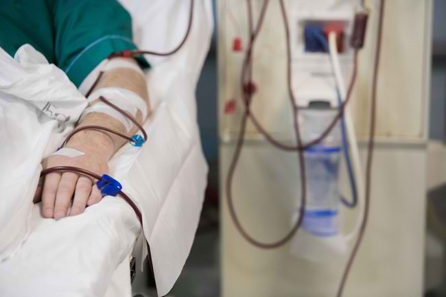 Uremia Dapat Berakibat Fatal, Pahami Gejala dan Pengobatannya - Alodokter