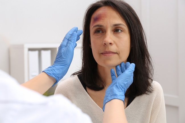 Hematoma - alodokter