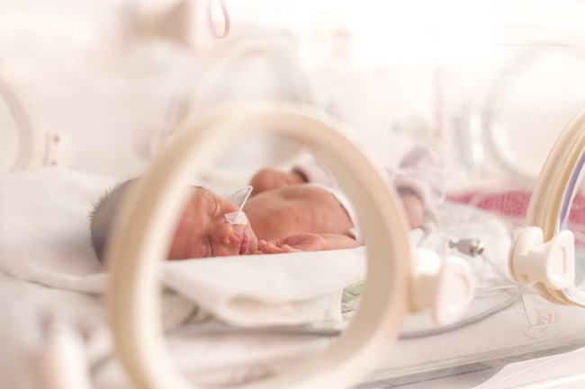 Penyebab Bayi Lahir Prematur - Alodokter