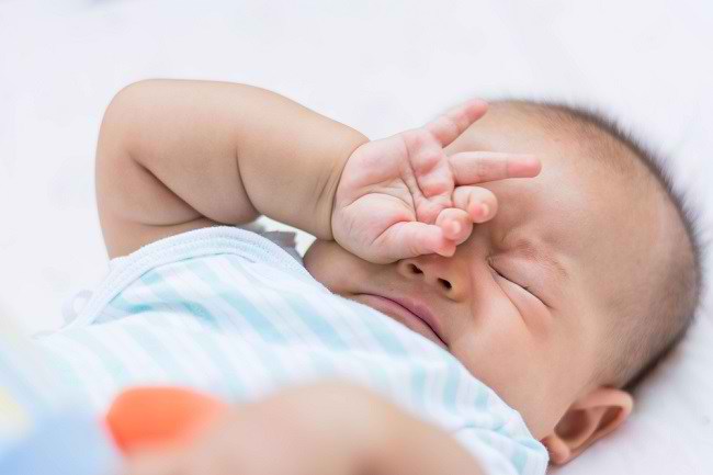 Yang Perlu Anda Ketahui Soal Mata Bayi Belekan - Alodokter