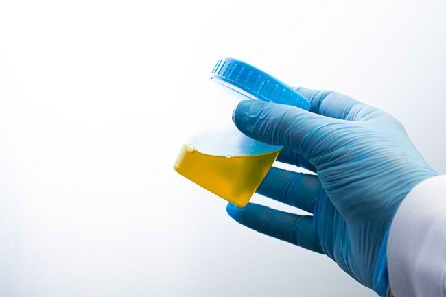 Sekilas tentang Sistem Kemih dan Proses Pembentukan Urine di Dalam Tubuh - Alodokter