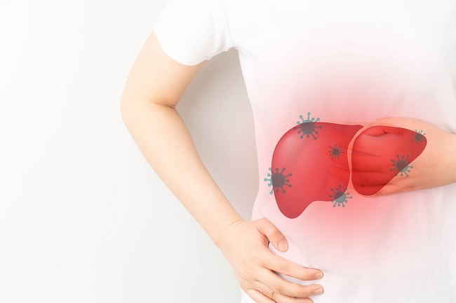 Hepatomegaly - alodokter