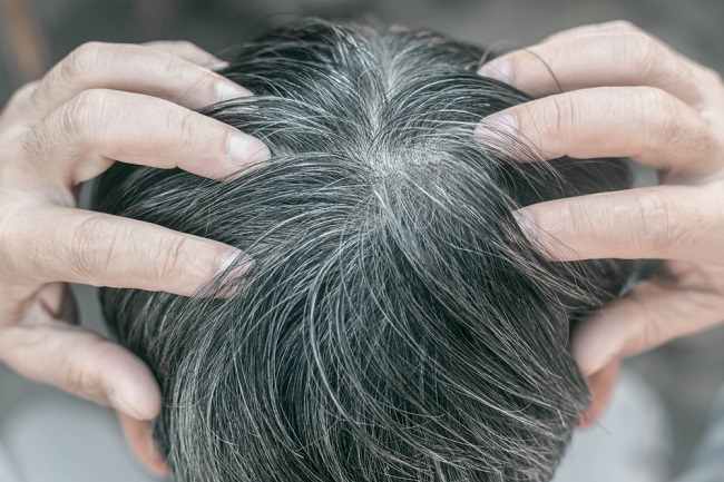 Penyebab Rambut  Menjadi Uban Alodokter