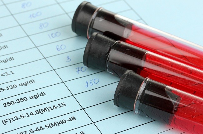 Complete Blood Examination Can Detect Disease - Alodokter