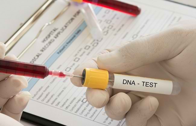 Apa yang Bisa Didapatkan dari Tes DNA? - Alodokter