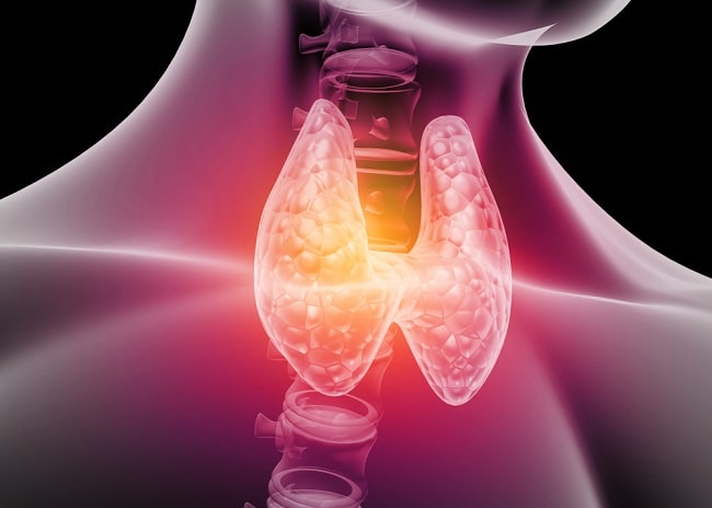 Hipotiroid Patofisiologi Diagnosis Penatalaksanaan Alomedika