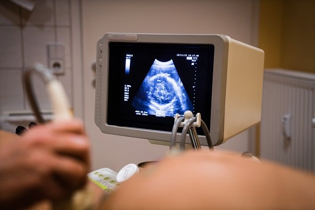 Janin Juga Bisa Mengalami Stres Lho Ini Penyebabnya Alodokter Janin Juga Bisa Mengalami Stres Lho Ini Penyebabnya Alodokter