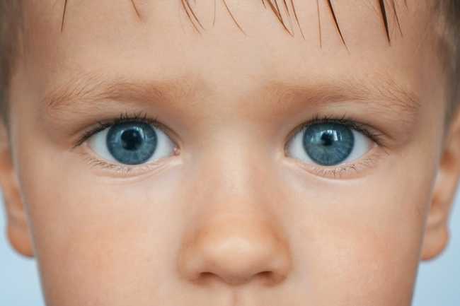 Anisocoria