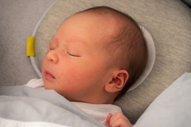 Ini penyebab Kepala Bayi Peyang dan Cara Mengatasinya - Alodokter